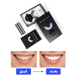دستگاه بلیچینگ گلوری اسمایل - تصویر 6