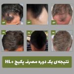 پکیج تقویت، ضدریزش و رویش مجدد مو - تصویر 2
